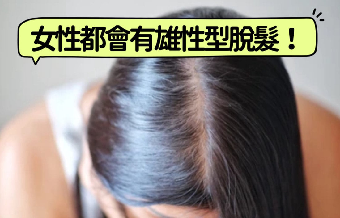 女性都會有雄性型脫髮!